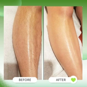 Medium arm hair removal (30 mins)